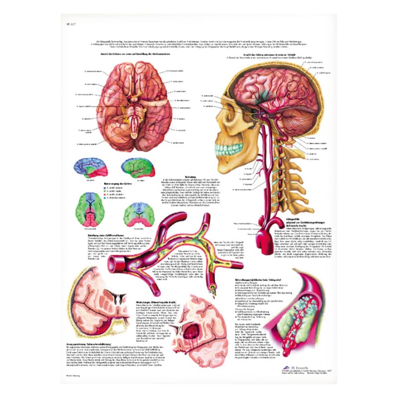 Stroke Wall Chart English