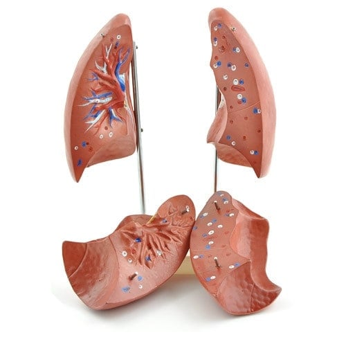 Lung Model