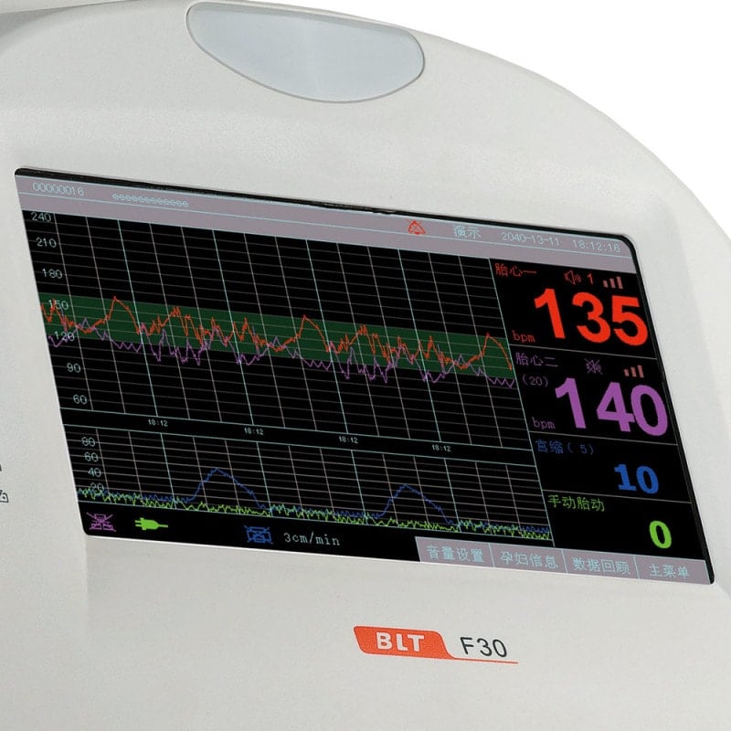 F30 Fetal Monitor