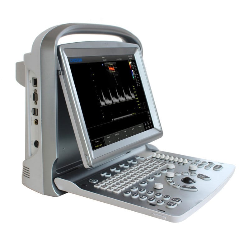 CHISON ECO5 Ultrasound Machine with Color Doppler + convex transducer
