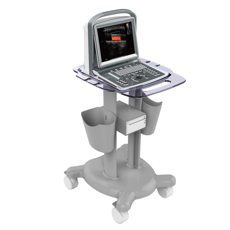 CHISON ECO5 Ultrasound Machine with Color Doppler + convex transducer