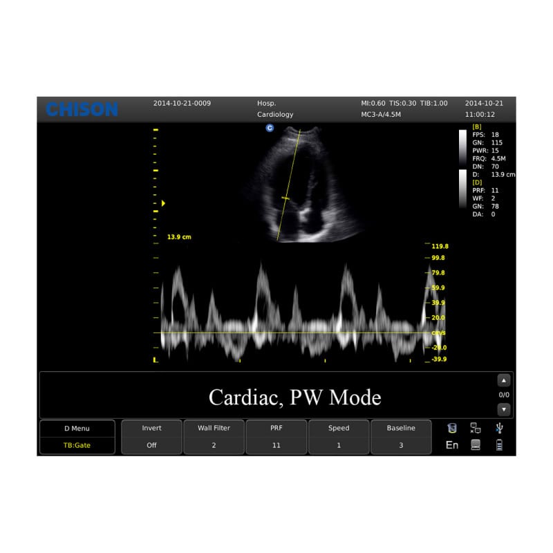 CHISON ECO3 Expert Ultrasound Machine with linear transducer (L7M-A)