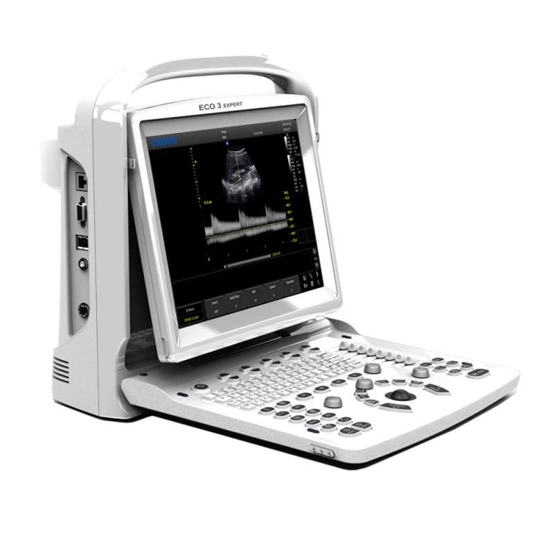 CHISON ECO3 Expert Ultrasound Machine with convex transducer (C3-A)