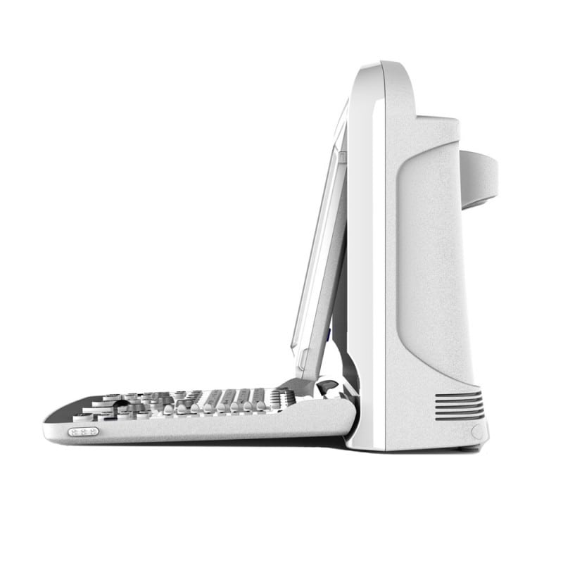 CHISON ECO3 Expert Ultrasound Machine with linear transducer (L7M-A)