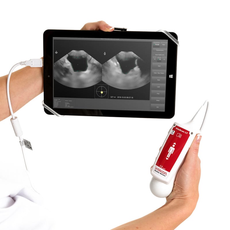 VitaScan v.2 Bladder Scanner System (incl. Transducer, Tablet)