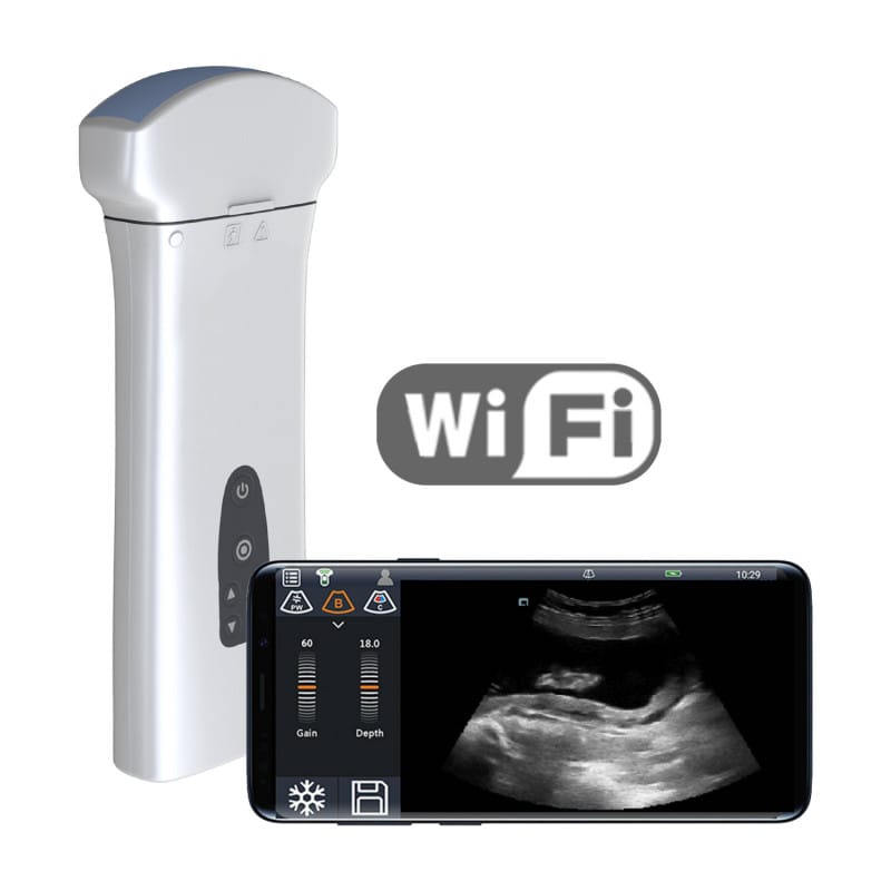 Youkey D8 Mobile Ultrasound Machine color | with micro-convex transducer (C8-5Ks)