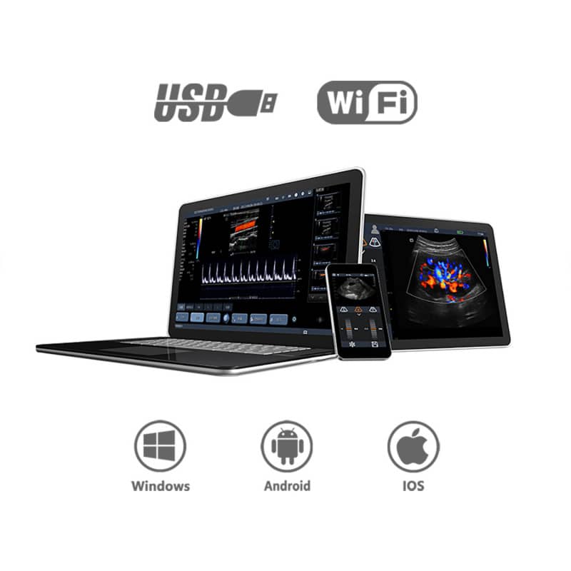 Youkey D8 Mobile Ultrasound Machine color | with convex transducer (C5-2Ks)