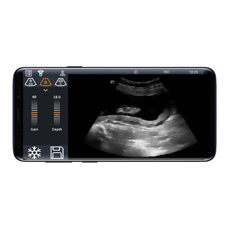 Youkey D8 Mobile Ultrasound Machine color | with linear transducer (L11-4Gs)