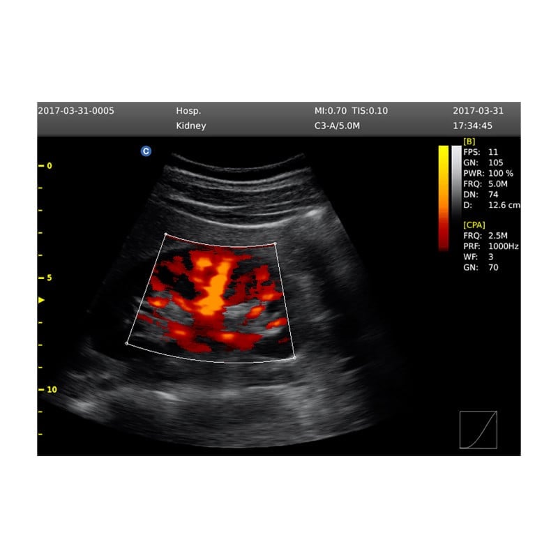 Chison ECO 6 Ultrasound Machine with C3-A convex transducer & P3-A phased array transducer