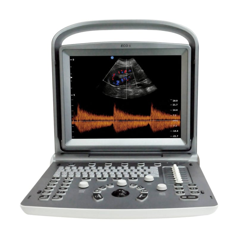 Chison ECO 6 Ultrasound Machine with C3-A convex transducer