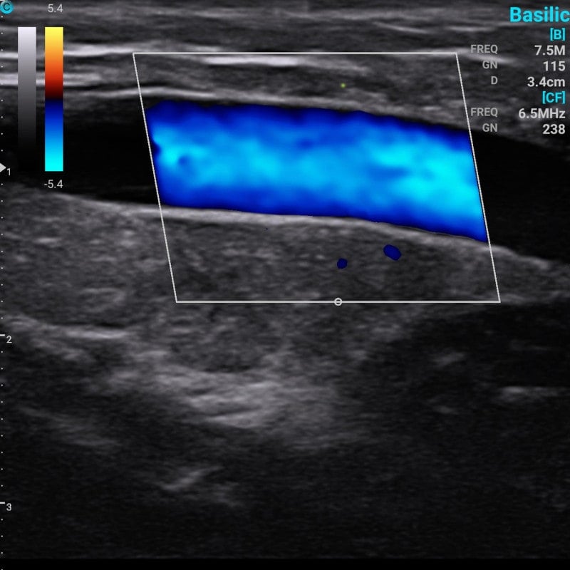 Chison Portable Ultrasound Machine “SonoEye” P5 (with 3.5 MHz convex transducer)