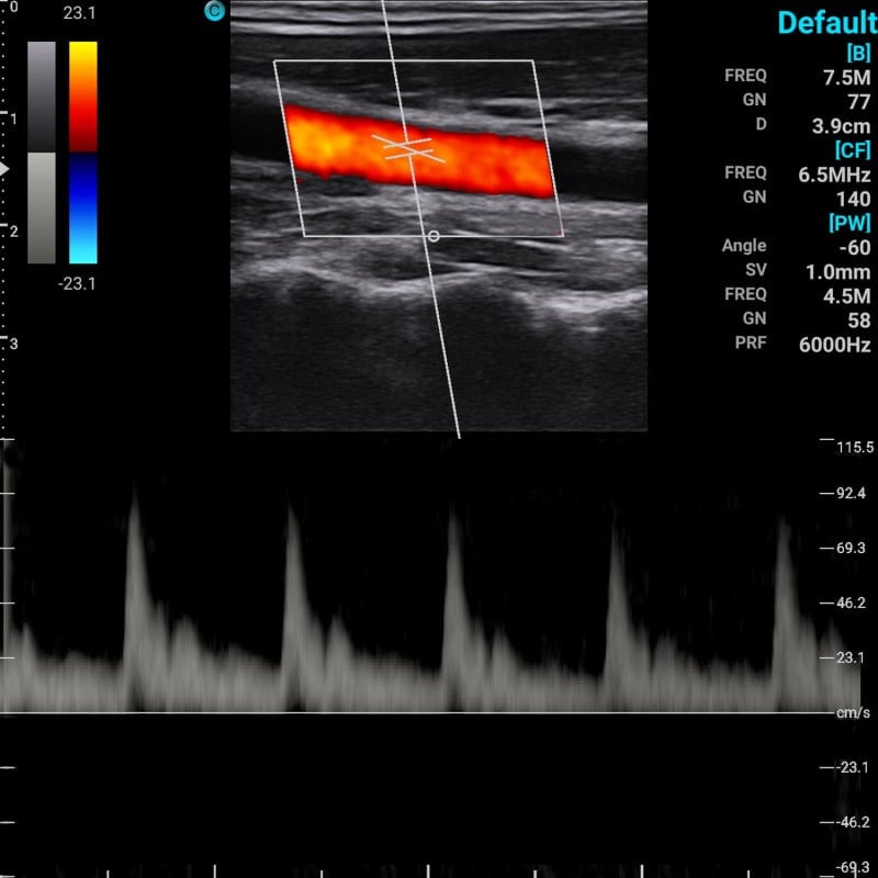 Chison Portable Ultrasound Machine “SonoEye” P5 (with 3.5 MHz convex transducer)