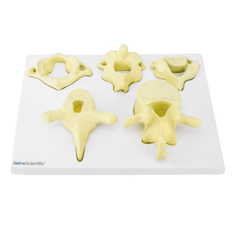 Model of Vertebrae Types