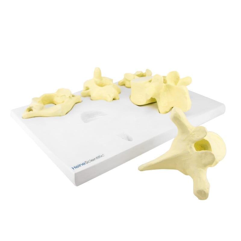 Model of Vertebrae Types