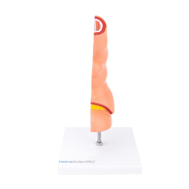 Oesophagus Model with Diseases