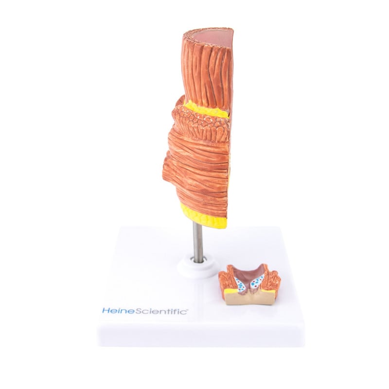 Haemorrhoid Model