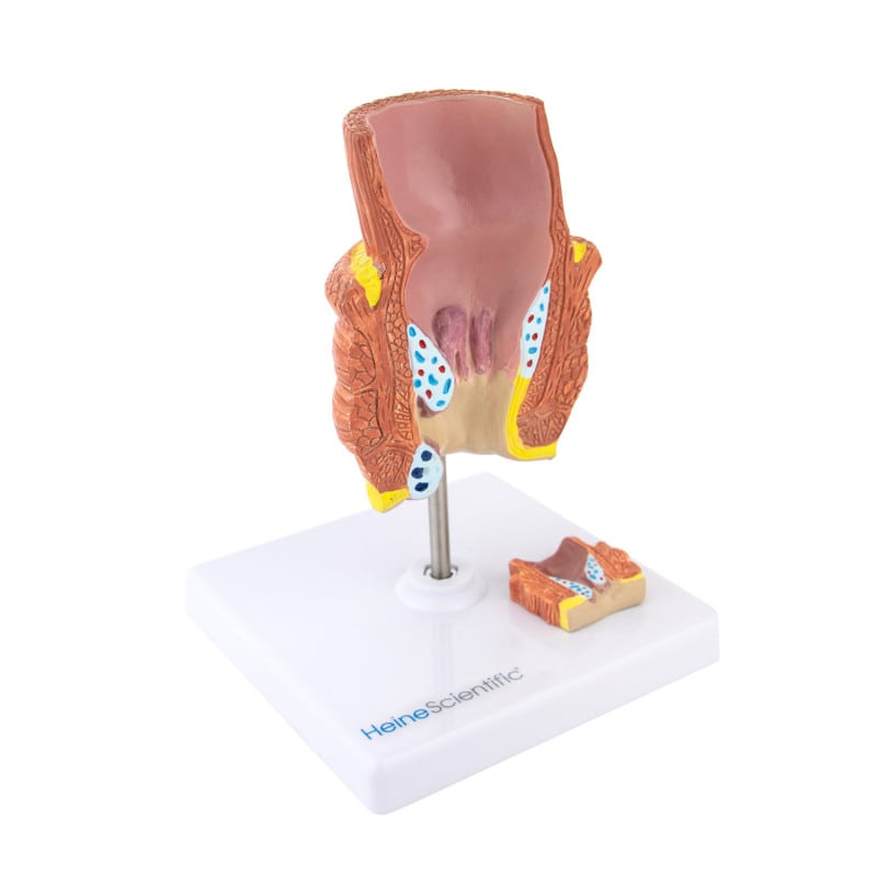 Haemorrhoid Model
