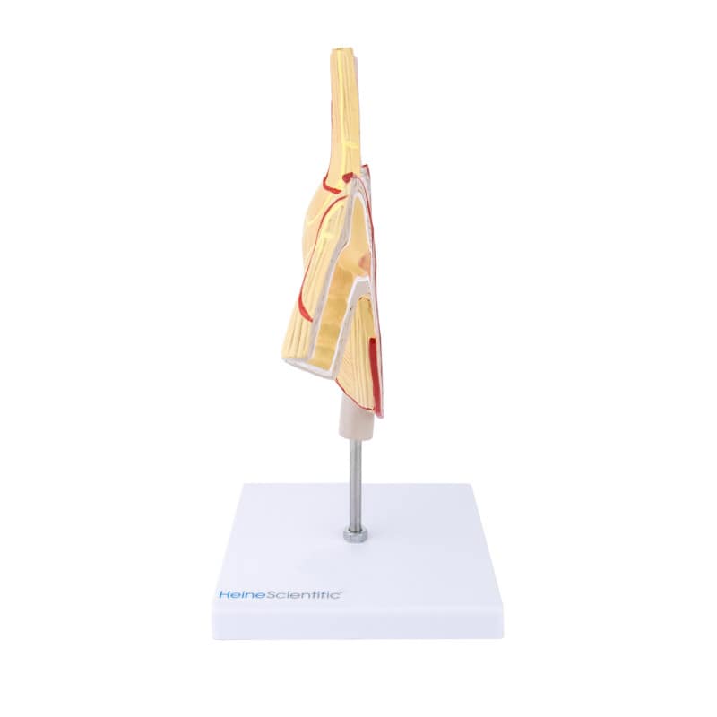 Stomach Model with Ulcers
