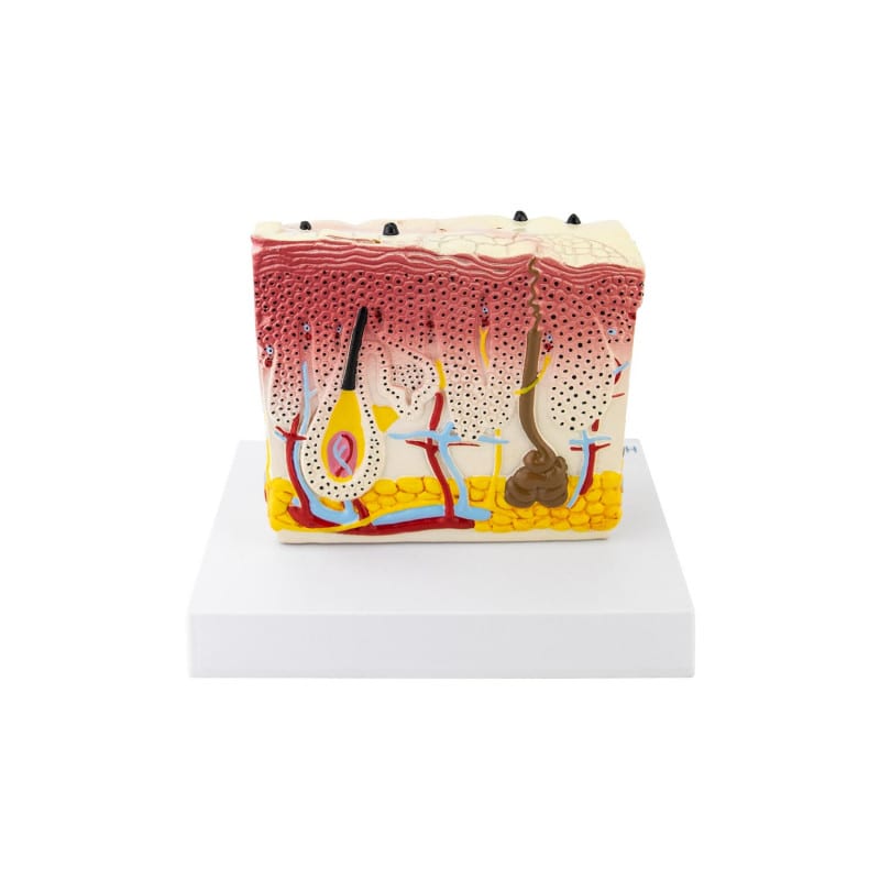 Model Skin with Psoriasis