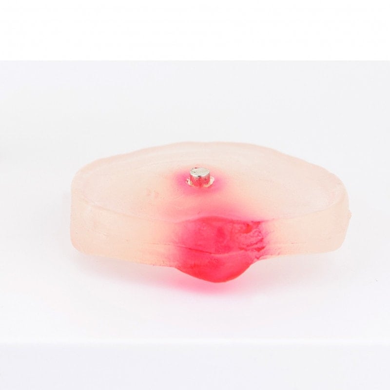 Herniated Disc Model