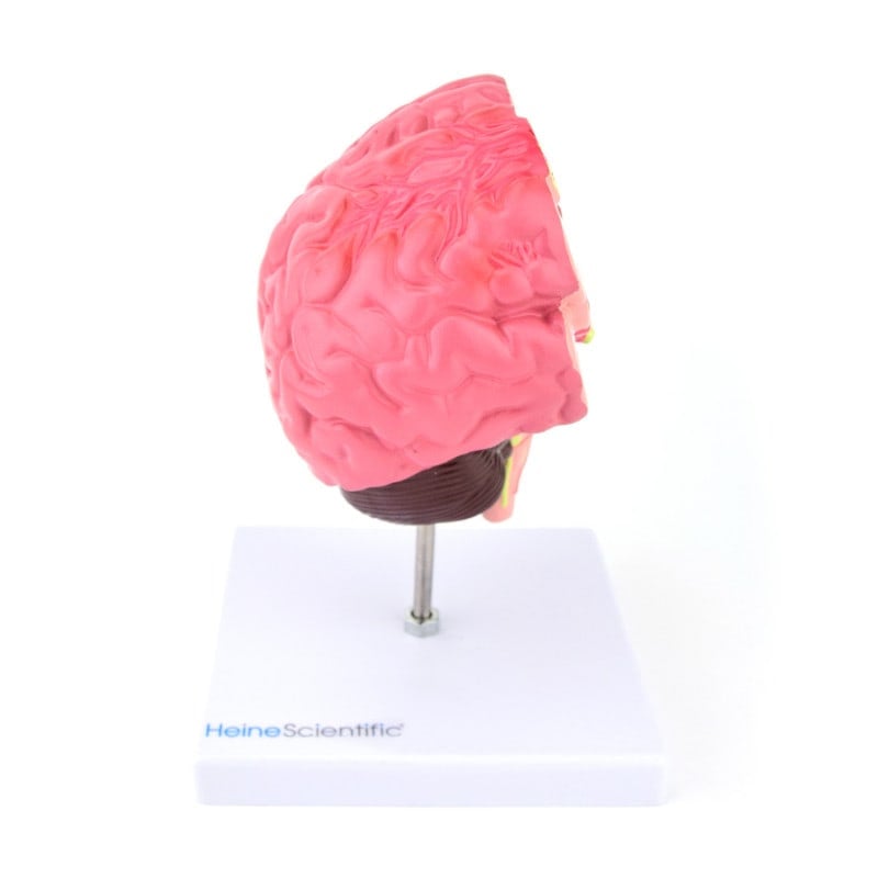 Brain Model with Diseases