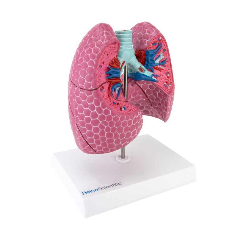 Lung Model with Diseases