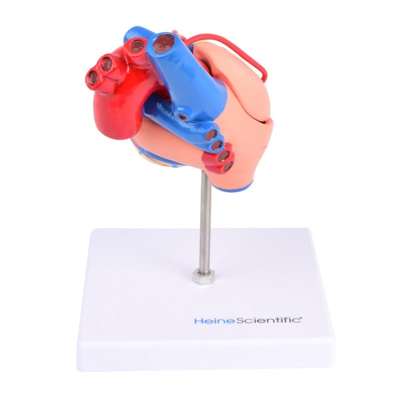 Heart Model with Bypass