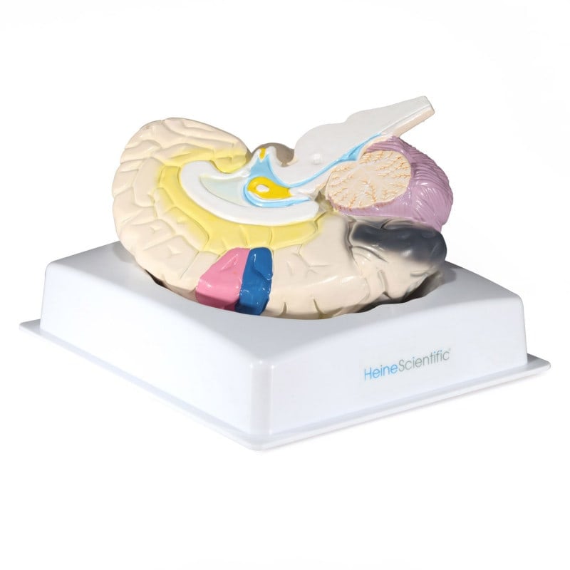 Brain with Functional Areas