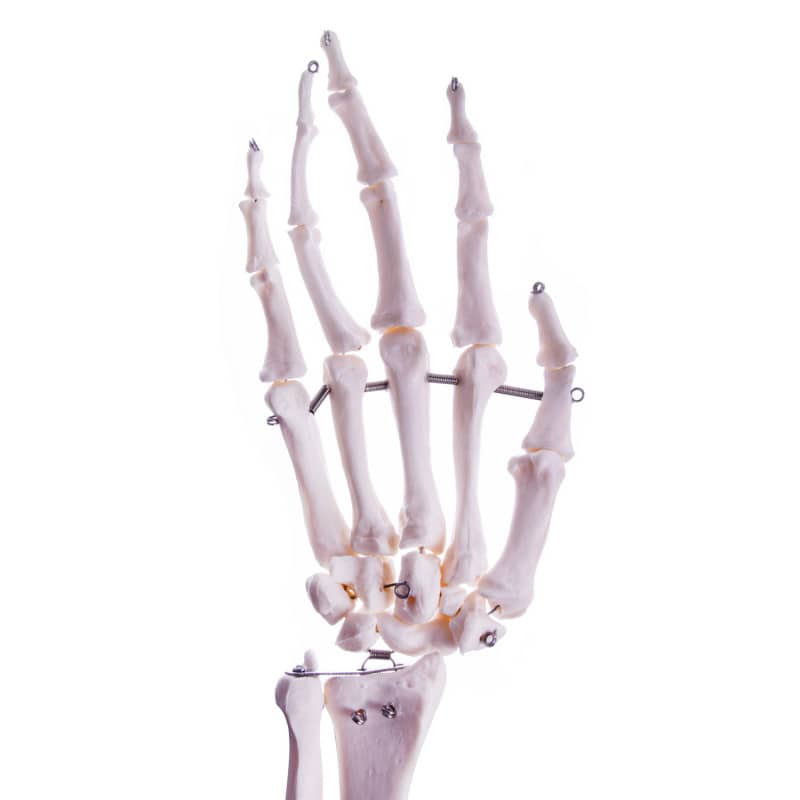 Arm Skeleton