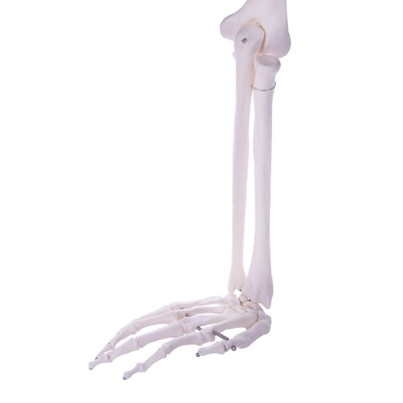 Arm Skeleton