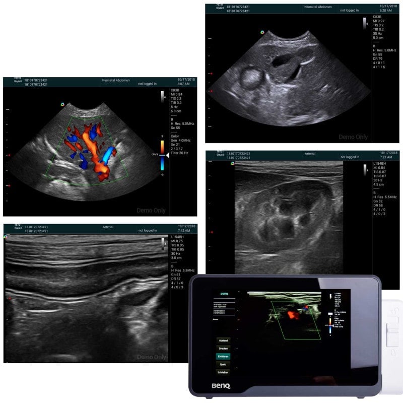 H1300 Portable Ultrasound with convex probe C62B