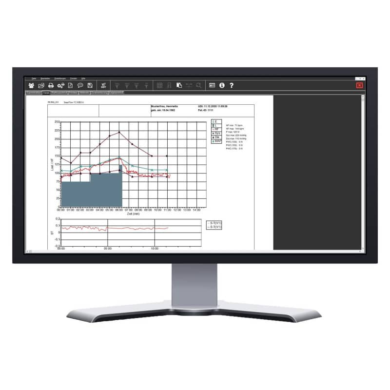 SmartScript Ergometry Basic Package