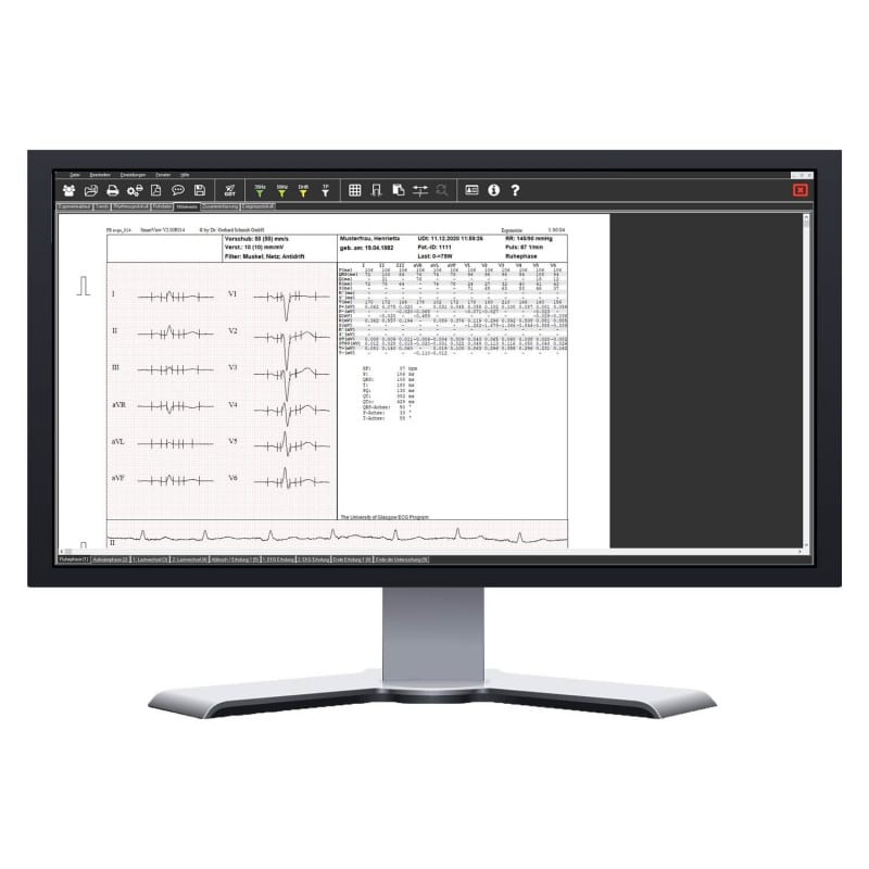 SmartScript Ergometry Basic Package