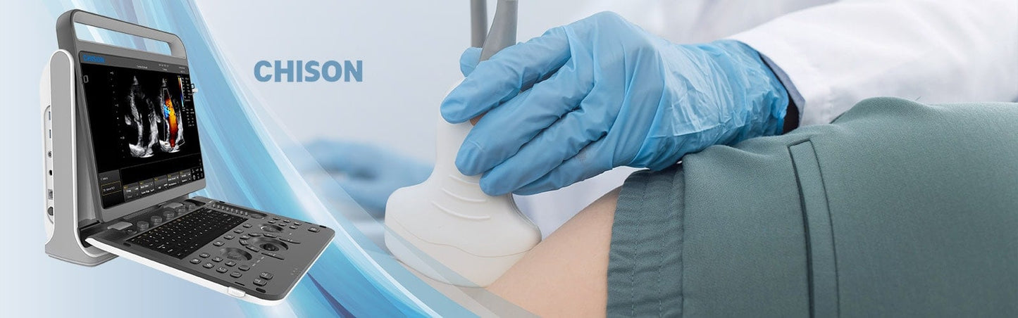 Chison EBit 60 Ultrasound System without ultrasound trolley