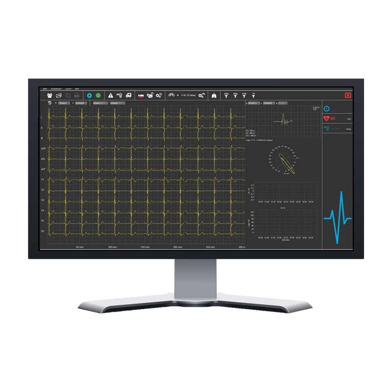 SmartScript PC-ECG System Bluetooth | Basic