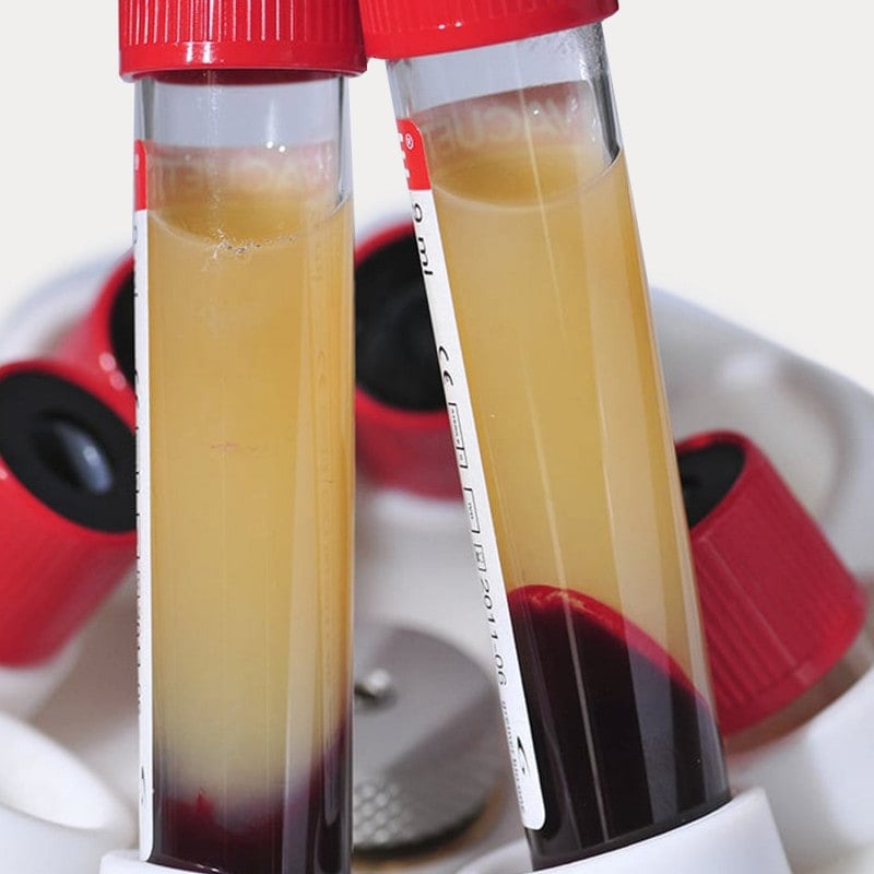 MEDIFUGE CGF Centrifuge