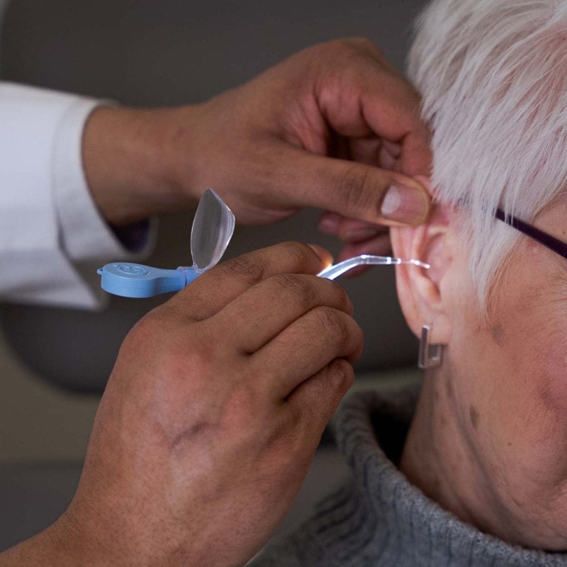 Bionix ClearLook Lighted Ear Curettes VersaLoop