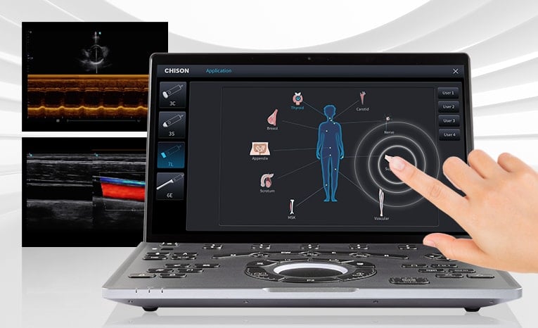 Chison SonoAir 70 Ultrasound System