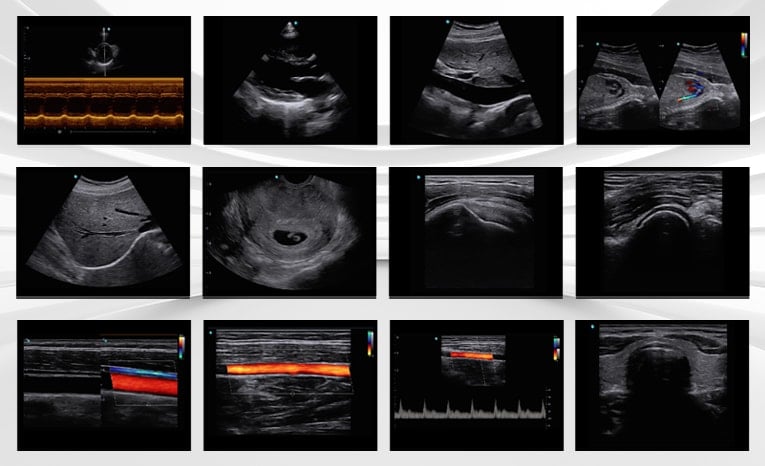 Chison SonoAir 70 Ultrasound System