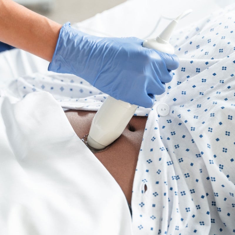 Vitascan cVue Bladder Scanner