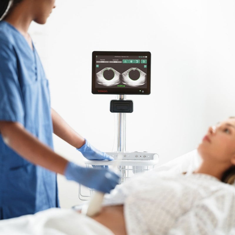 Vitascan cVue Bladder Scanner