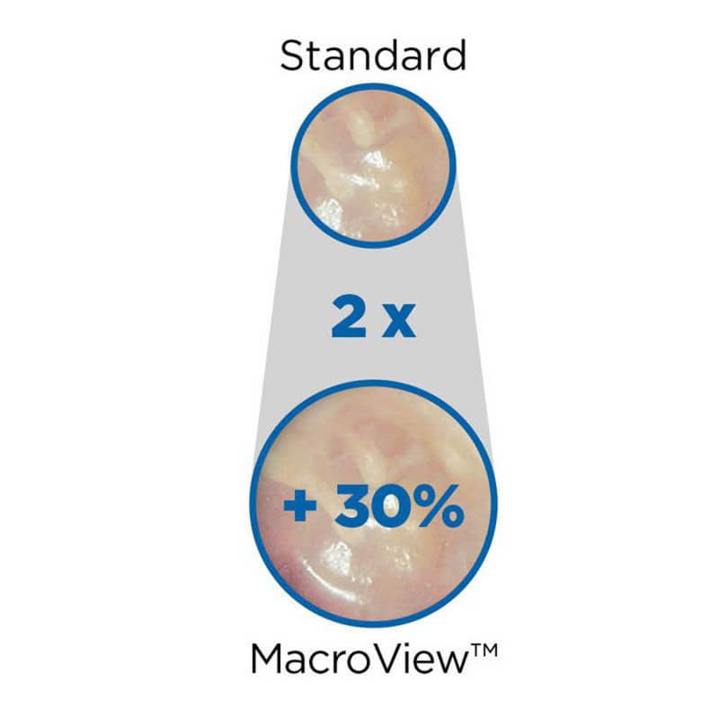 MacroView™ Prestige™ LED Otoscope Set