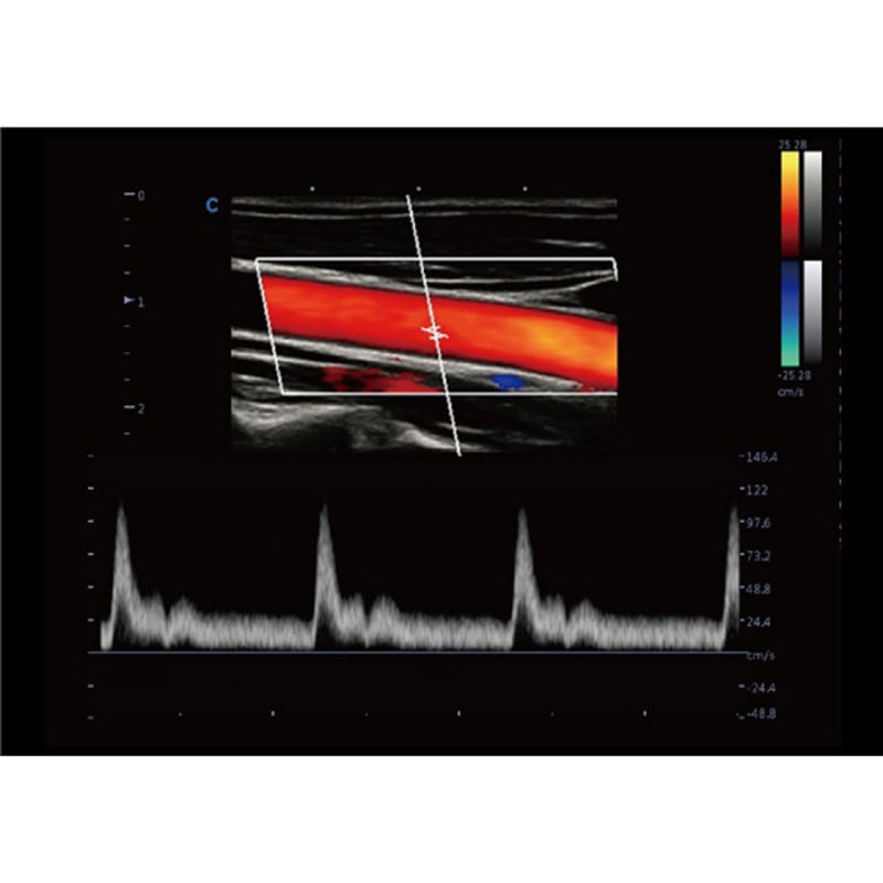 CBit 9 Color Doppler Ultrasound System with battery