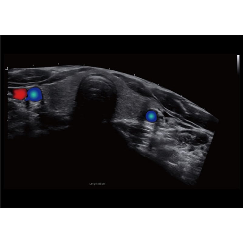 CBit 9 Color Doppler Ultrasound System without battery
