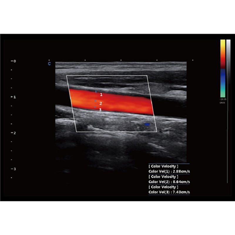 CBit 9 Color Doppler Ultrasound System with battery