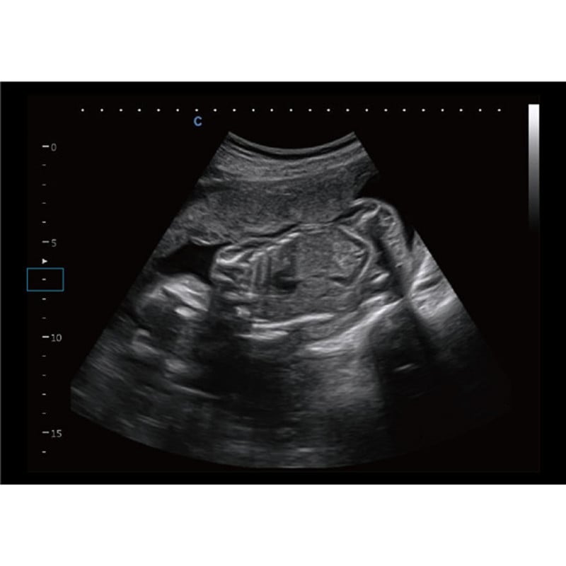 CBit 9 Color Doppler Ultrasound System without battery