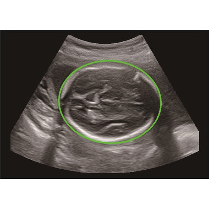 CBit 9 Color Doppler Ultrasound System without battery