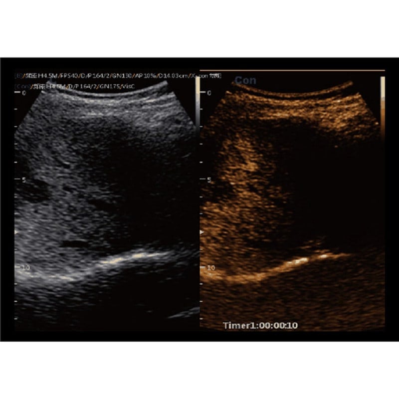 CBit 9 Color Doppler Ultrasound System with battery