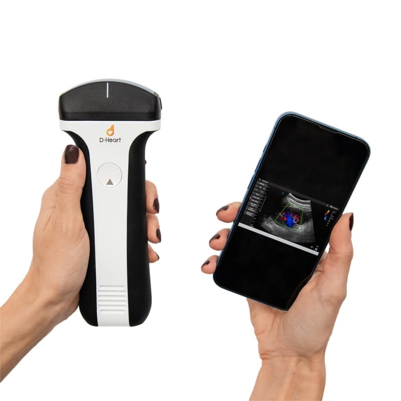 D-Heart Handheld Ultrasound Scanner linear | without tablet