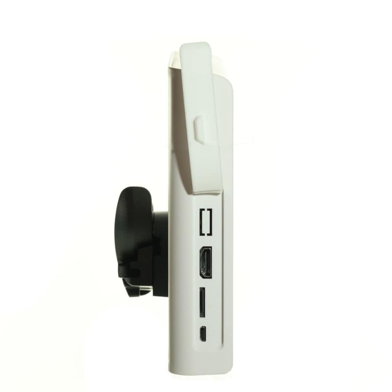 Bronchoscopy Monitor